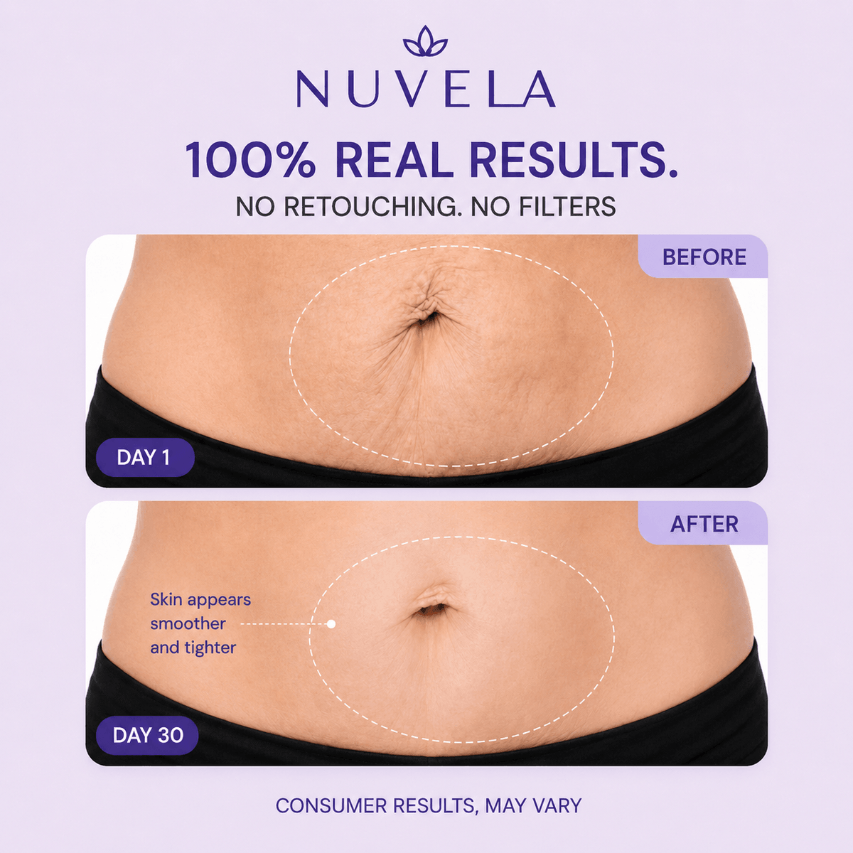 Nuvela Tighten & Smooth Belly Cream