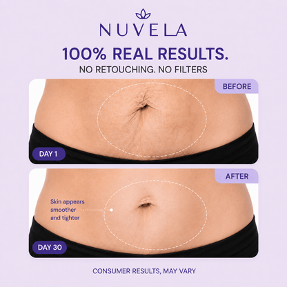 Nuvela Tighten & Smooth Belly Cream