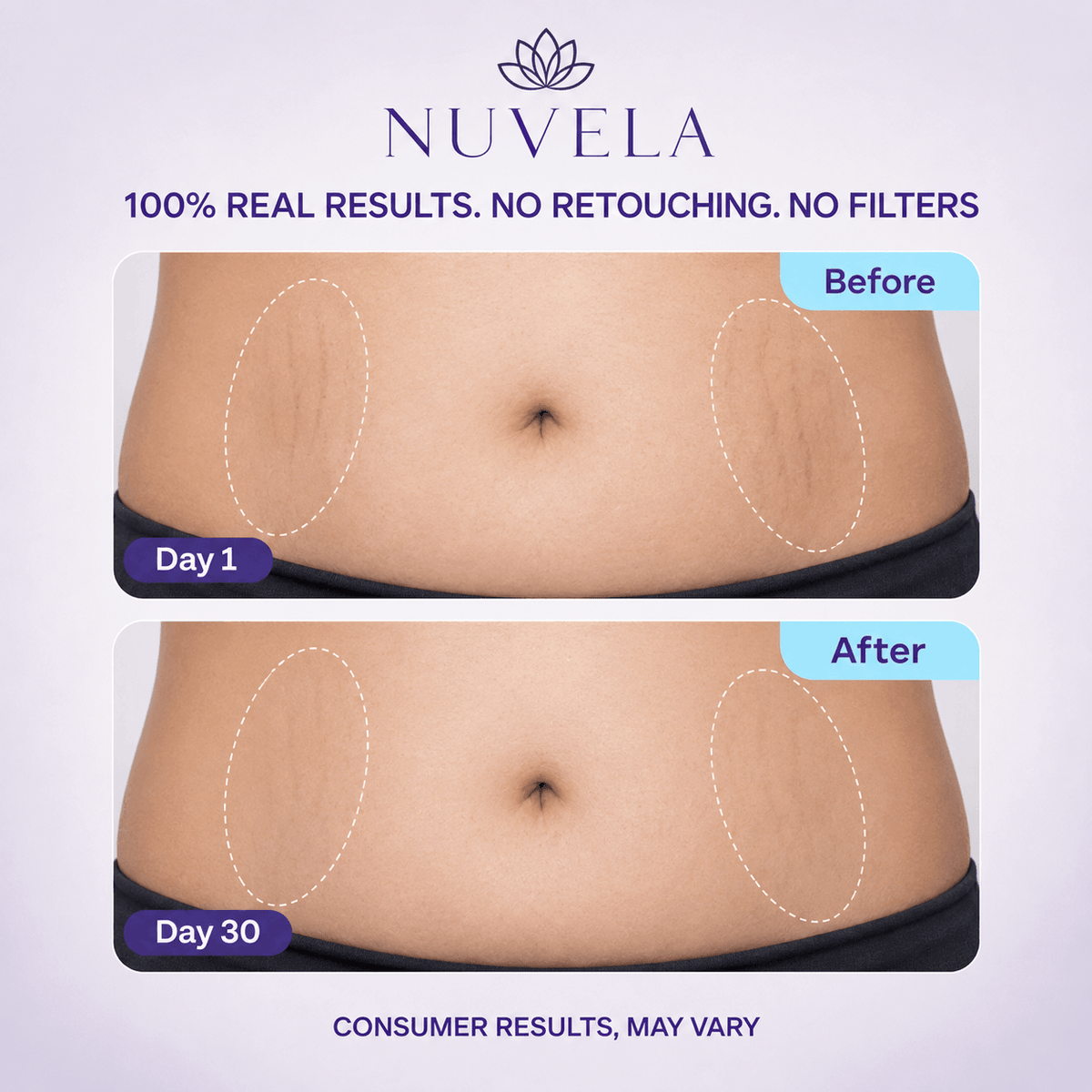 Nuvela Tighten & Smooth Belly Cream