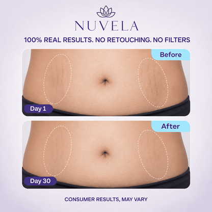 Nuvela Tighten & Smooth Belly Cream