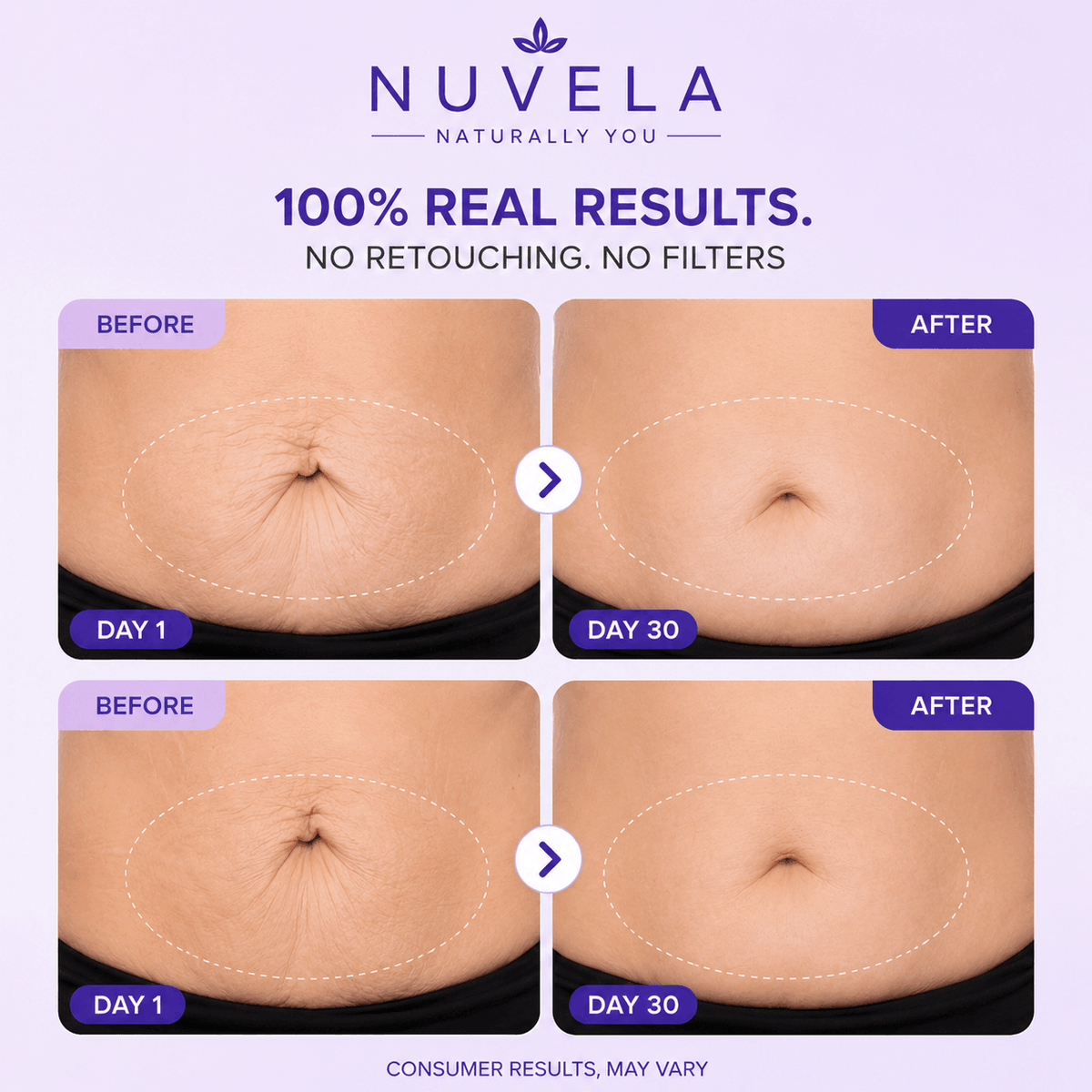Nuvela Tighten & Smooth Belly Cream