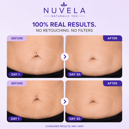 Nuvela Tighten & Smooth Belly Cream